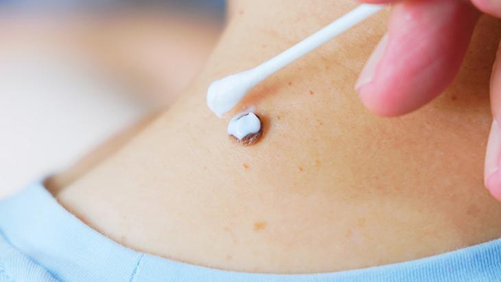 lazerle aldiran da var solusyon suren de her ben masum degil incelenmeli NVfKj97u.jpg