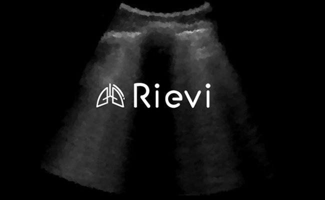 Yapay Zeka ile Akciğer Ultrasonunun Yorumlanması